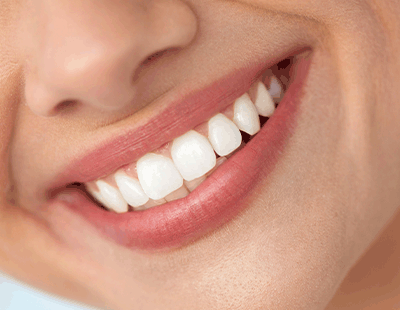 Sedation Dentist in Menifee