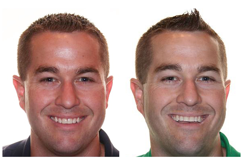 Legacy Dental of Menifee