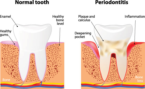 Sedation Dentist in Menifee