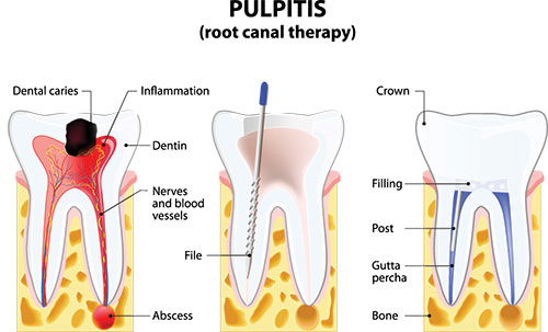 Sleep Apnea Dentist Menifee